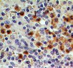 CCR1 Antibody in Immunohistochemistry (Paraffin) (IHC (P))