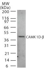 CAMK1D Antibody in Western Blot (WB)