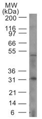 Caspase 14 Antibody in Western Blot (WB)