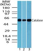 Catalase Antibody in Western Blot (WB)