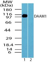 DAAM1 Antibody in Western Blot (WB)