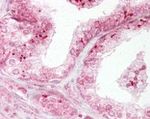 DIABLO Antibody in Immunohistochemistry (IHC)