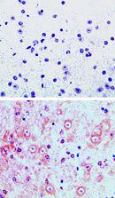DMAP1 Antibody in Immunohistochemistry (Paraffin) (IHC (P))