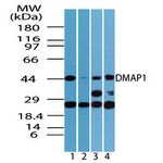 DMAP1 Antibody in Western Blot (WB)