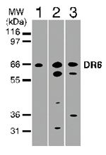 DR6 Antibody in Western Blot (WB)