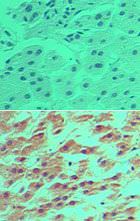 DRAM Antibody in Immunohistochemistry (Paraffin) (IHC (P))