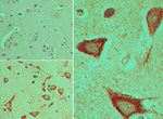 DVL3 Antibody in Immunohistochemistry (Paraffin) (IHC (P))