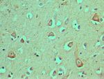 DEC1 Antibody in Immunohistochemistry (Paraffin) (IHC (P))