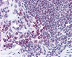 CRM1 Antibody in Immunohistochemistry (IHC)