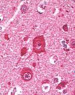 FNBP1 Antibody in Immunohistochemistry (Paraffin) (IHC (P))