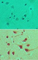 FNBP1 Antibody in Immunohistochemistry (Paraffin) (IHC (P))
