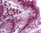 FOXC1 Antibody in Immunohistochemistry (IHC)
