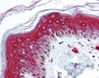 FOXO3A Antibody in Immunohistochemistry (IHC)