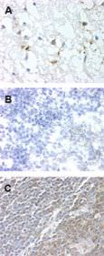 GPR83 Antibody in Immunohistochemistry (Paraffin) (IHC (P))