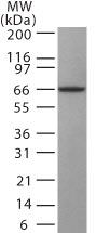 GAD67 Antibody in Western Blot (WB)