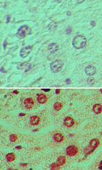 GARP Antibody in Immunohistochemistry (Paraffin) (IHC (P))