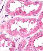GNPDA1 Antibody in Immunohistochemistry (Paraffin) (IHC (P))