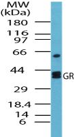 GSR Antibody in Western Blot (WB)