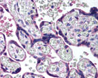 HAPLN3 Antibody in Immunohistochemistry (IHC)