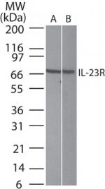 IL23R Antibody in Western Blot (WB)