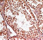 LIN28A Antibody in Immunohistochemistry (Paraffin) (IHC (P))