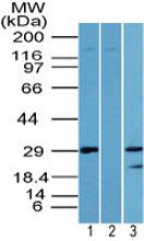 LIN28A Antibody in Western Blot (WB)