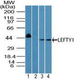 Lefty1/Lefty2 Antibody in Western Blot (WB)