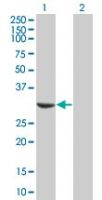 EB1 Antibody in Western Blot (WB)