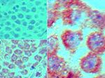 MEIS1 Antibody in Immunohistochemistry (Paraffin) (IHC (P))