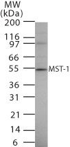 MSP Antibody in Western Blot (WB)
