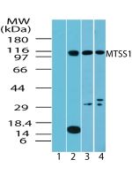 MTSS1 Antibody in Western Blot (WB)