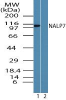 NALP7 Antibody in Western Blot (WB)