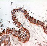 NFkB p65 Antibody in Immunohistochemistry (IHC)