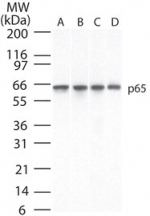 NFkB p65 Antibody in Western Blot (WB)