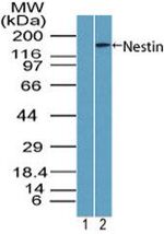 Nestin Antibody in Western Blot (WB)