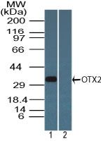 OTX2 Antibody in Western Blot (WB)