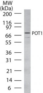 POT1 Antibody in Western Blot (WB)