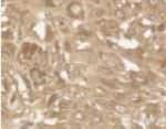 PUMA alpha Antibody in Immunohistochemistry (IHC)