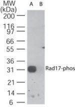 Phospho-RAD17 (Ser647) Antibody in Western Blot (WB)