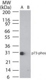 Phospho-p73 (Tyr99) Antibody in Western Blot (WB)