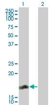 RGS13 Antibody in Western Blot (WB)