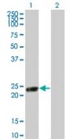 RGS5 Antibody in Western Blot (WB)