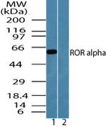 RORA Antibody in Western Blot (WB)
