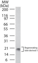REG1A Antibody in Western Blot (WB)