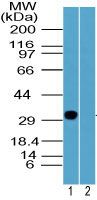 Rhox2 Antibody in Western Blot (WB)