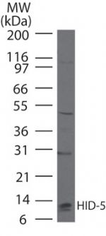 S100A7 Antibody in Western Blot (WB)