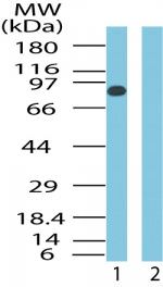 SMO Antibody in Western Blot (WB)