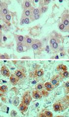 GPR91 Antibody in Immunohistochemistry (Paraffin) (IHC (P))