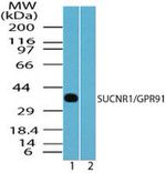 GPR91 Antibody in Western Blot (WB)