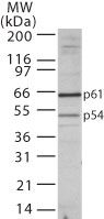 TBLR1 Antibody in Western Blot (WB)